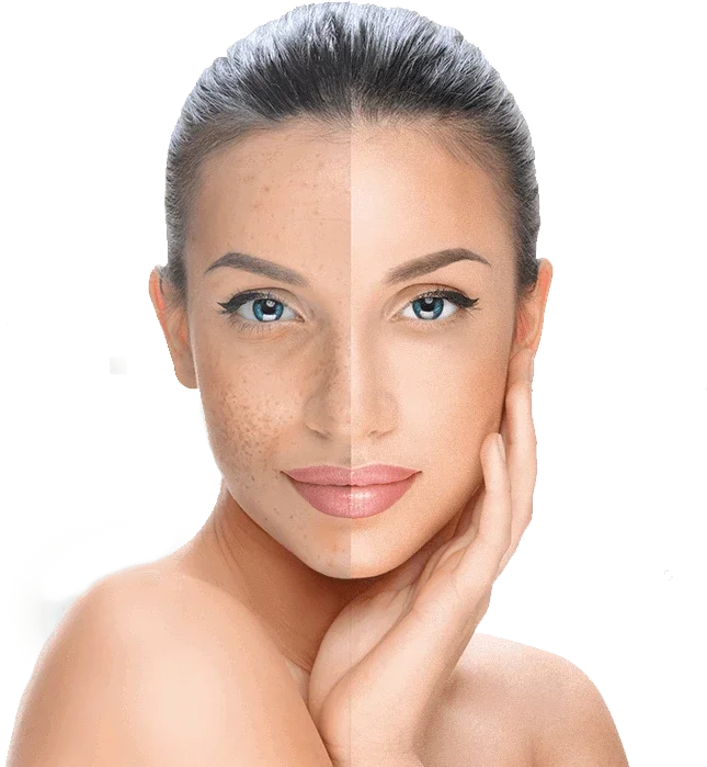 Cuidado Facial en Madrid Sol, Salamanca y Castellana | Lashes Original